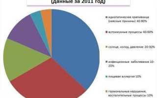 Лечение крапивницы в домашних условиях у взрослых и детей народными средствами